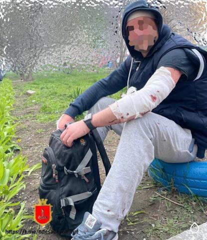 As a result of the missile strike in Odesa, 18 people were injured and 5 died, including a three-month-old baby